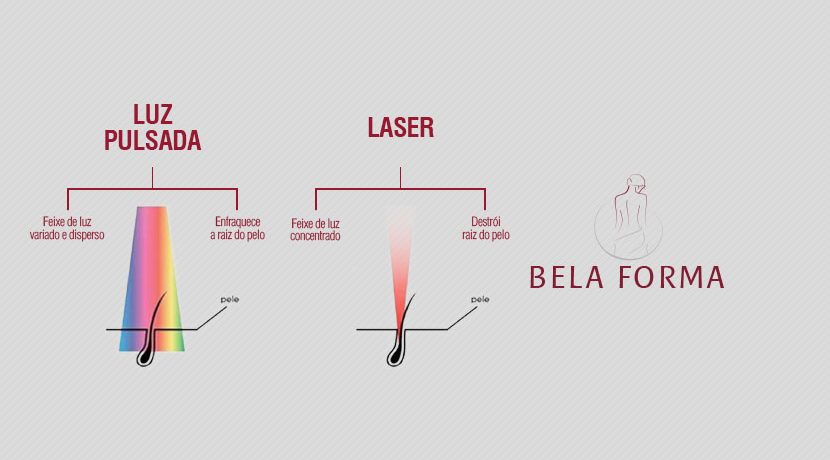 Você sabe a diferença entre Luz Pulsada e Laser?