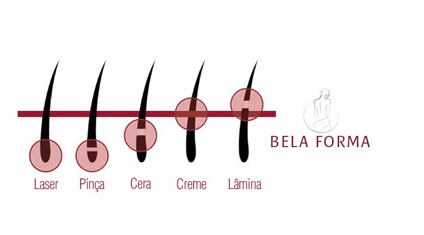 Depilação: laser, lâmina ou cera?